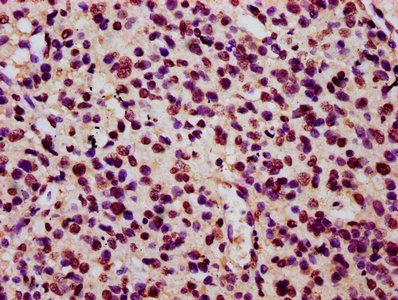 HIST1H3A (Ab-27) Antibody