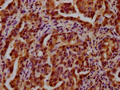HIST1H3A (Ab-27) Antibody