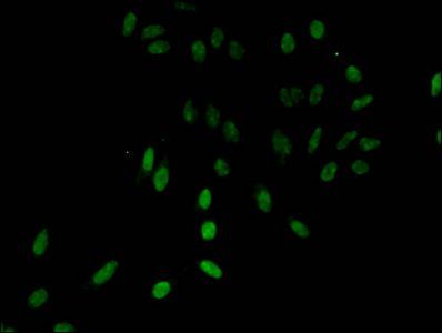 HIST1H3A (Ab-28) Antibody