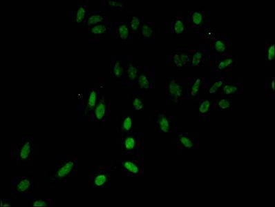 HIST1H3A (Ab-28) antibody