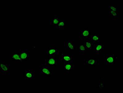 HIST1H3A (Ab-28) antibody