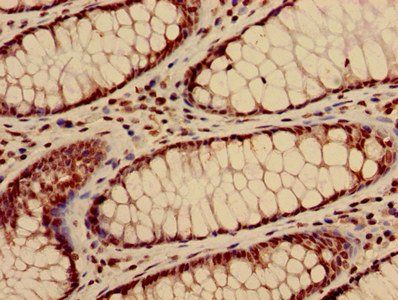 HIST1H3A (Ab-28) Antibody