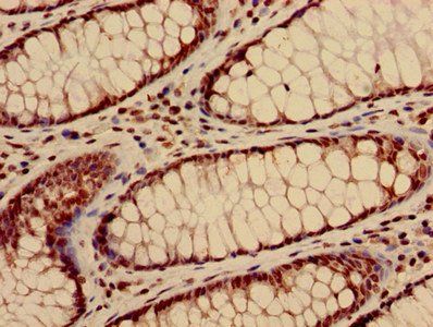 HIST1H3A (Ab-28) antibody