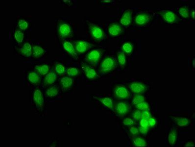 HIST1H3A (Ab-28) antibody