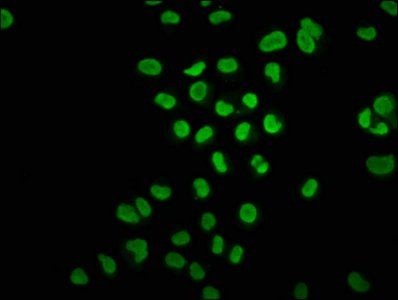 HIST1H3A (Ab-3) antibody