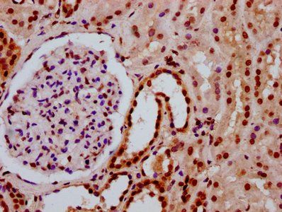 HIST1H3A (Ab-3) Antibody