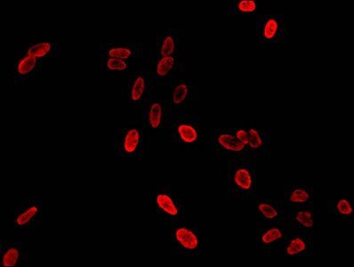 HIST1H3A (Ab-36) antibody