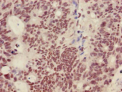 HIST1H3A (Ab-36) Antibody