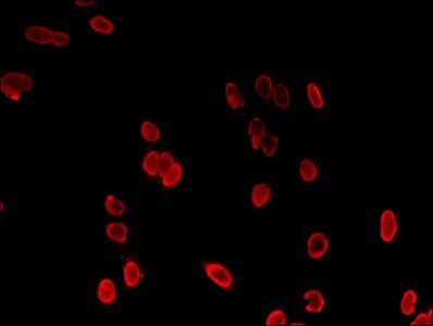 HIST1H3A (Ab-36) Antibody