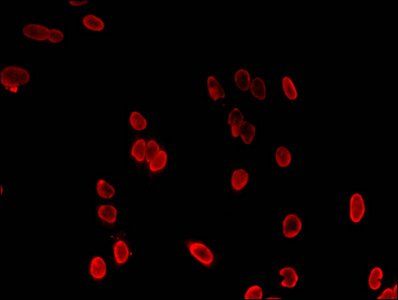 HIST1H3A (Ab-36) antibody