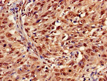 HIST1H3A (Ab-36) Antibody