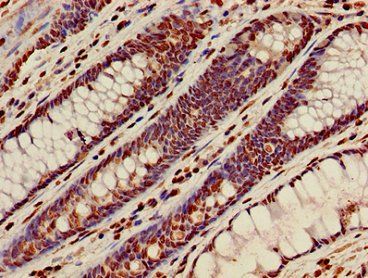 HIST1H3A (Ab-36) Antibody