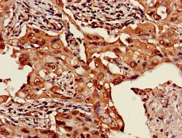 HIST1H3A (Ab-36) Antibody