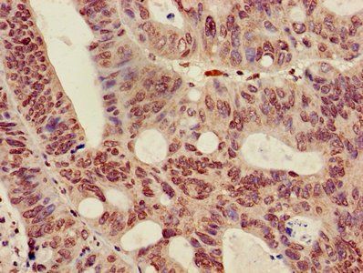 HIST1H3A (Ab-36) Antibody