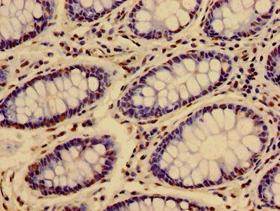 HIST1H3A (Ab-36) Antibody