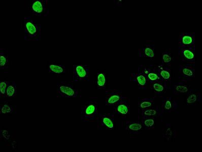 HIST1H3A (Ab-36) antibody