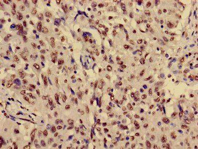 HIST1H3A (Ab-36) Antibody