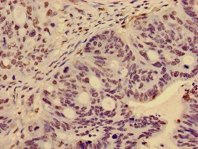 HIST1H3A (Ab-36) Antibody