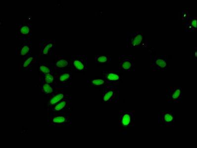 HIST1H3A (Ab-4) antibody