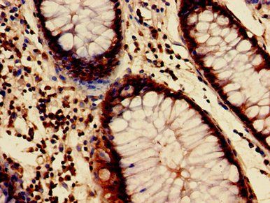 HIST1H3A (Ab-4) Antibody