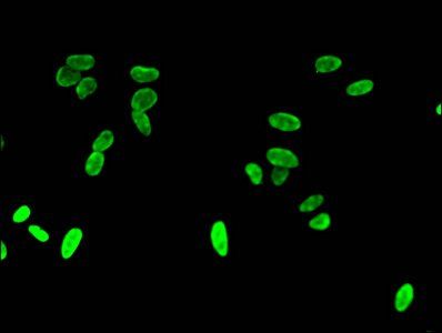 HIST1H3A (Ab-4) Antibody