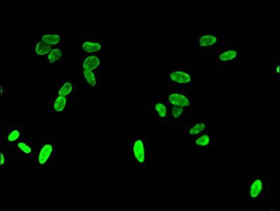 HIST1H3A (Ab-4) antibody