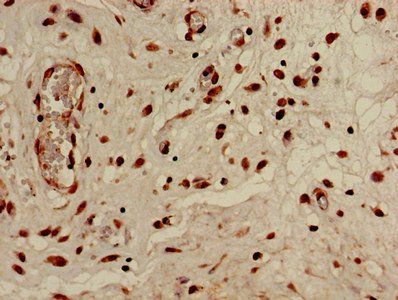 HIST1H3A (Ab-4) Antibody