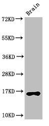 HIST1H3A (Ab-4) Antibody