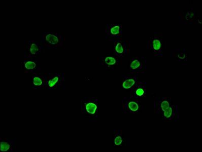 HIST1H3A (Ab-4) antibody