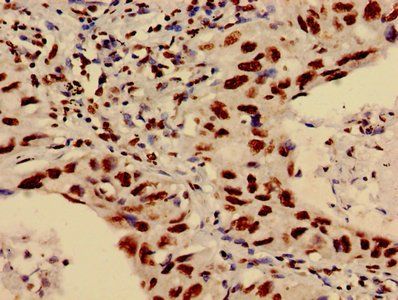 HIST1H3A (Ab-4) Antibody