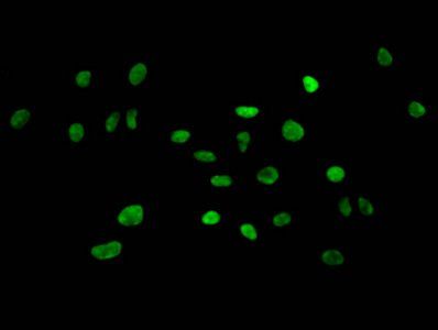 HIST1H3A (Ab-4) Antibody