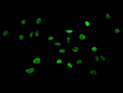 HIST1H3A (Ab-4) antibody