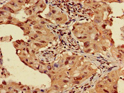 HIST1H3A (Ab-4) Antibody