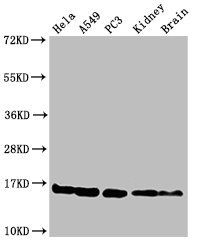 HIST1H3A (Ab-4) antibody