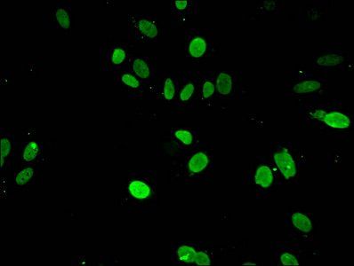 HIST1H3A (Ab-4) antibody