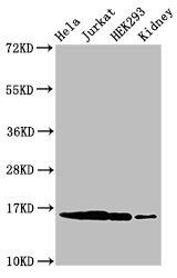 HIST1H3A (Ab-4) antibody