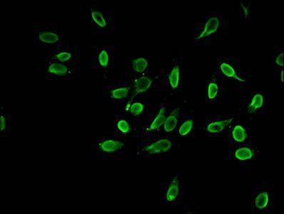 HIST1H3A (Ab-4) antibody