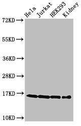 HIST1H3A (Ab-4) antibody