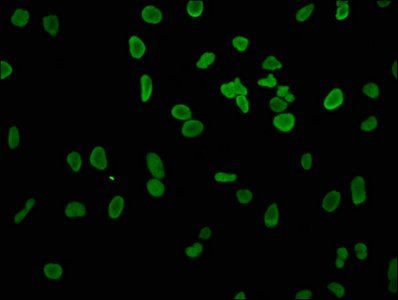 HIST1H3A (Ab-4) Antibody
