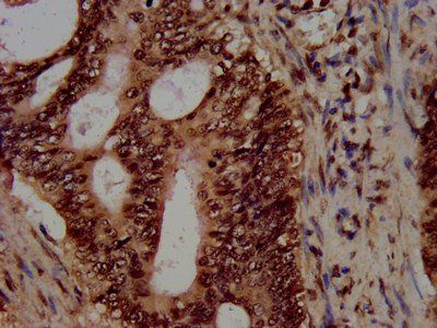 HIST1H3A (Ab-4) Antibody