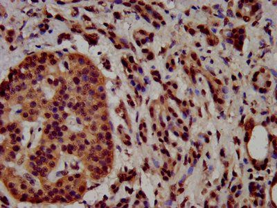 HIST1H3A (Ab-4) Antibody