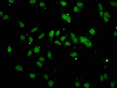 HIST1H3A (Ab-4) Antibody