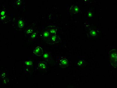 HIST1H3A (Ab-4) Antibody