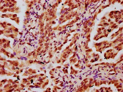 HIST1H3A (Ab-4) Antibody