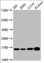 HIST1H3A (Ab-4) Antibody
