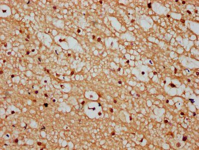 HIST1H3A (Ab-4) Antibody