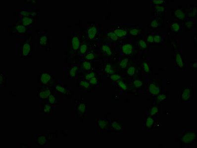 HIST1H3A (Ab-45) antibody