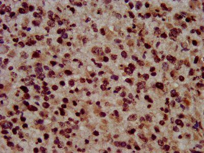 HIST1H3A (Ab-45) Antibody