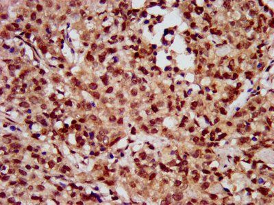 HIST1H3A (Ab-56) Antibody