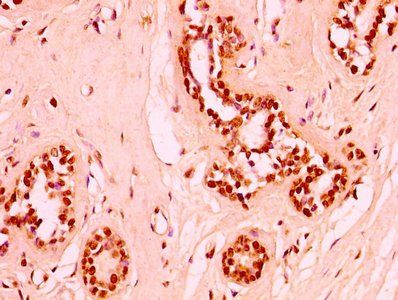 HIST1H3A (Ab-6) Antibody
